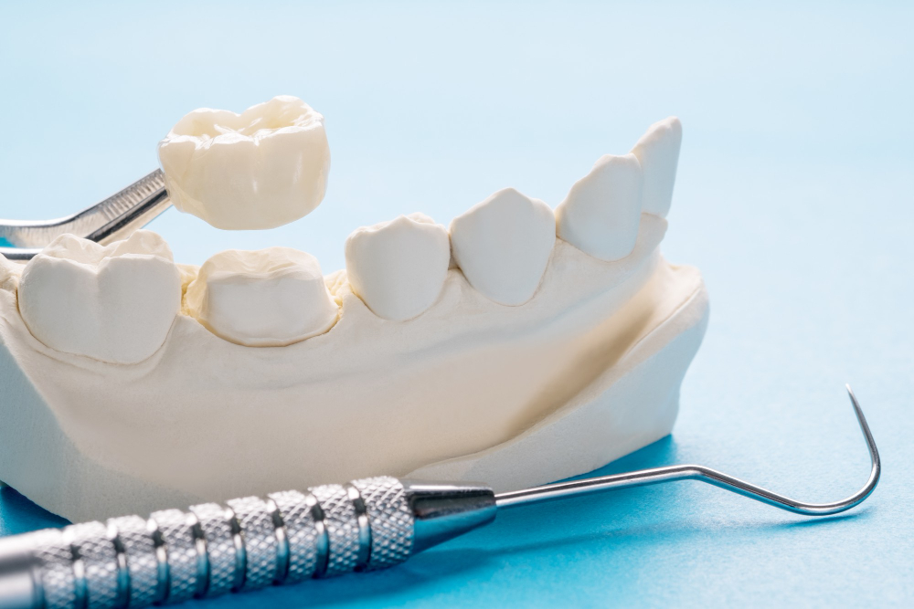 closeup-prosthodontics-prosthetic-single-teeth-crown-bridge-equipment-model-express-fix-restoration.jpg