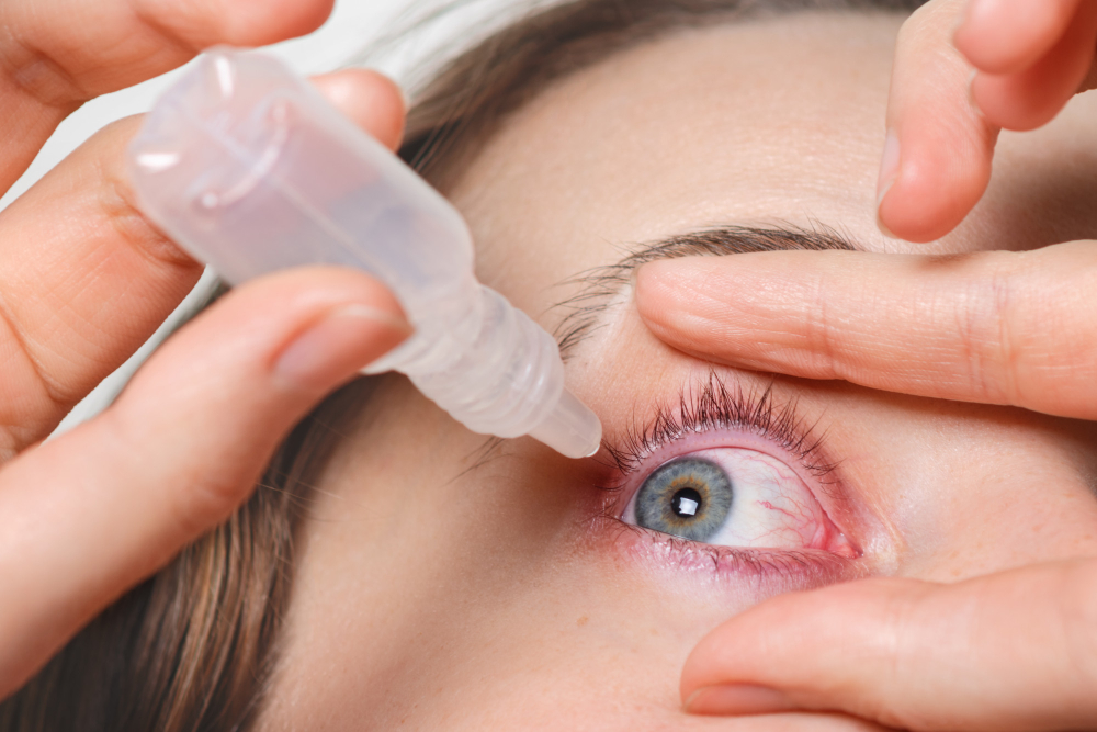 close-up-female-pours-drops-red-eye-has-conjuctivitis-glaucoma-bad-eyesight-pain-eyes-pain-treatment-concept-woman-cures-red-blood-eye.jpg